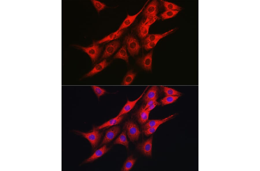 Immunofluorescence - Anti-IRE1 Antibody (A92812) - Antibodies.com