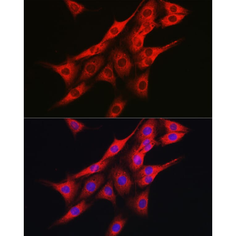 Immunofluorescence - Anti-IRE1 Antibody (A92812) - Antibodies.com