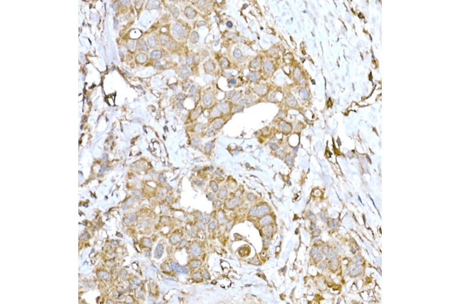 Immunohistochemistry - Anti-IRE1 Antibody (A92812) - Antibodies.com