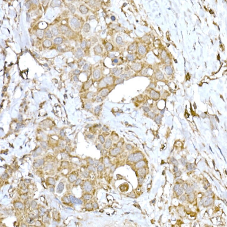 Immunohistochemistry - Anti-IRE1 Antibody (A92812) - Antibodies.com