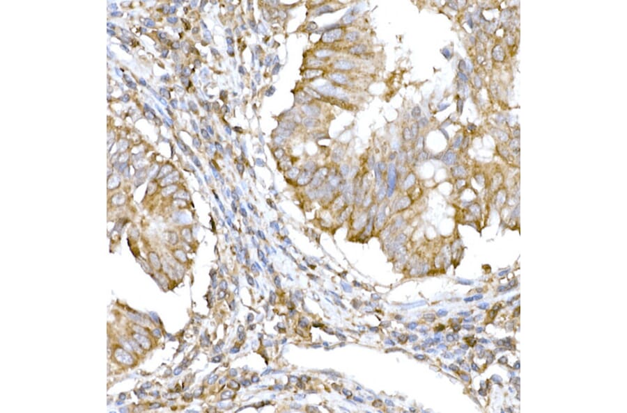Immunohistochemistry - Anti-IRE1 Antibody (A92812) - Antibodies.com