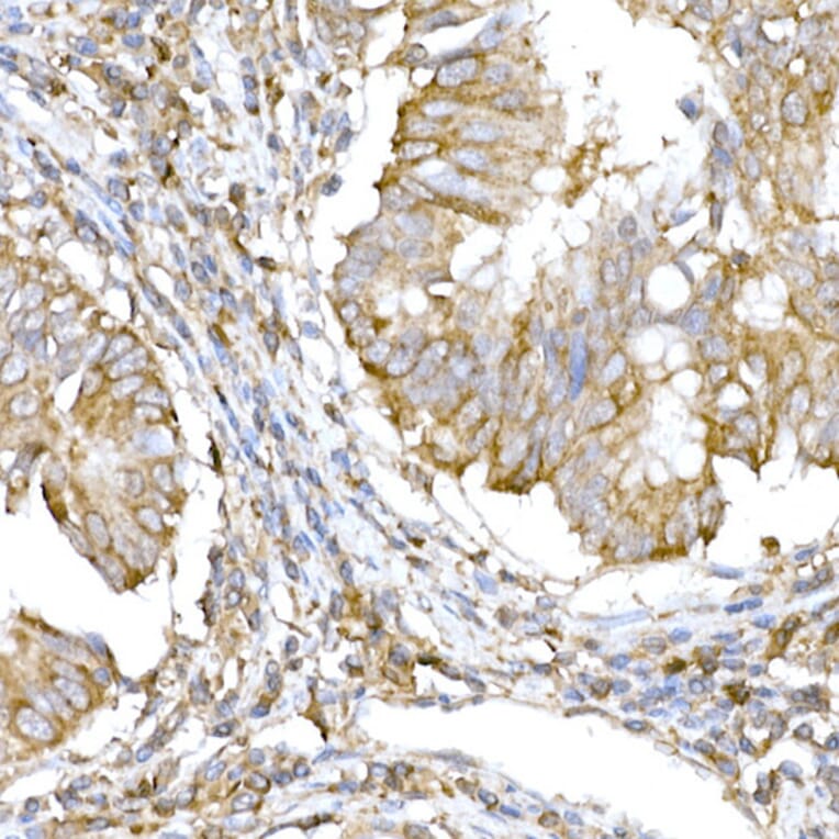 Immunohistochemistry - Anti-IRE1 Antibody (A92812) - Antibodies.com