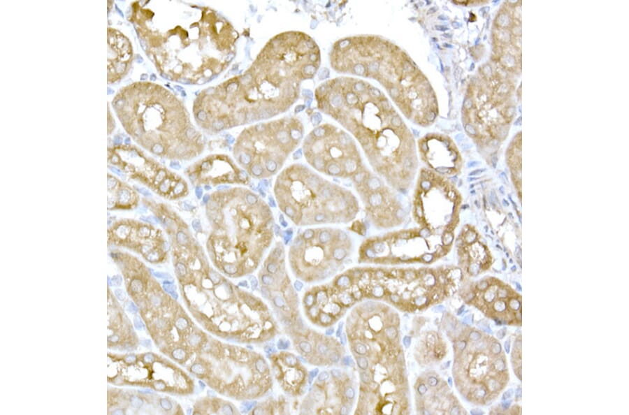Immunohistochemistry - Anti-IRE1 Antibody (A92812) - Antibodies.com