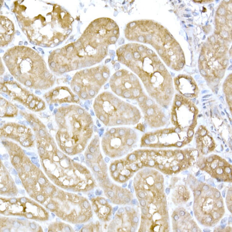 Immunohistochemistry - Anti-IRE1 Antibody (A92812) - Antibodies.com