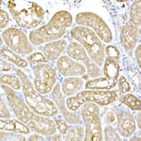 Immunohistochemistry - Anti-IRE1 Antibody (A92812) - Antibodies.com
