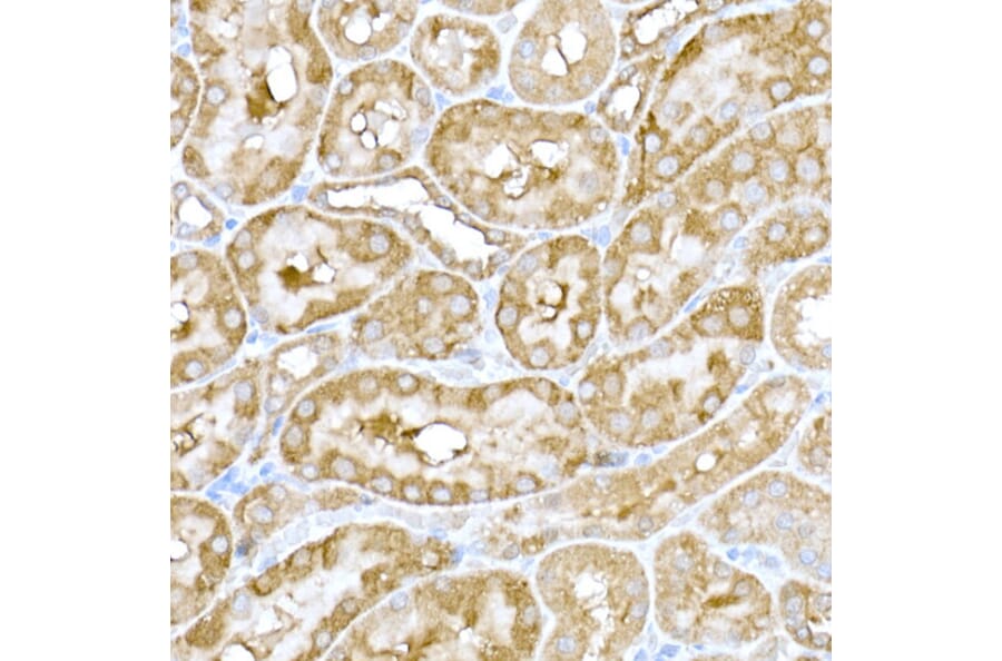 Immunohistochemistry - Anti-IRE1 Antibody (A92812) - Antibodies.com