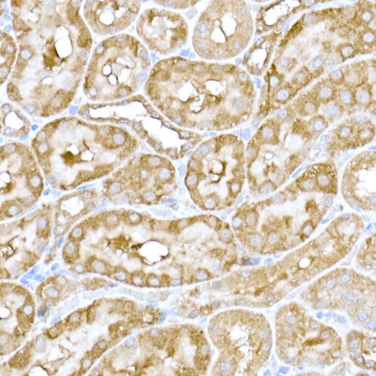 Immunohistochemistry - Anti-IRE1 Antibody (A92812) - Antibodies.com