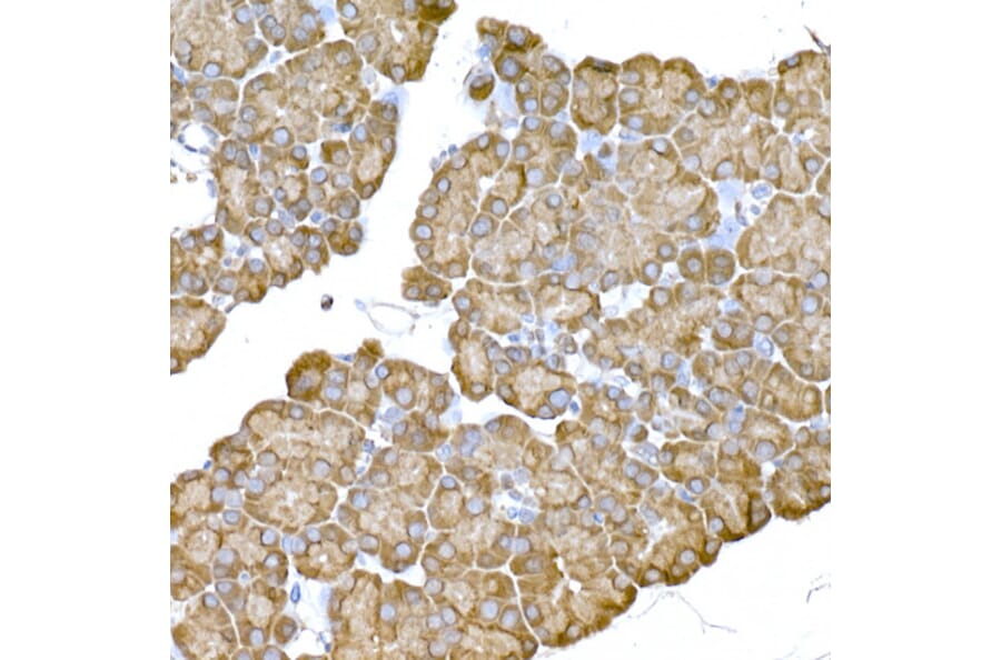 Immunohistochemistry - Anti-IRE1 Antibody (A92812) - Antibodies.com