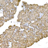 Immunohistochemistry - Anti-IRE1 Antibody (A92812) - Antibodies.com