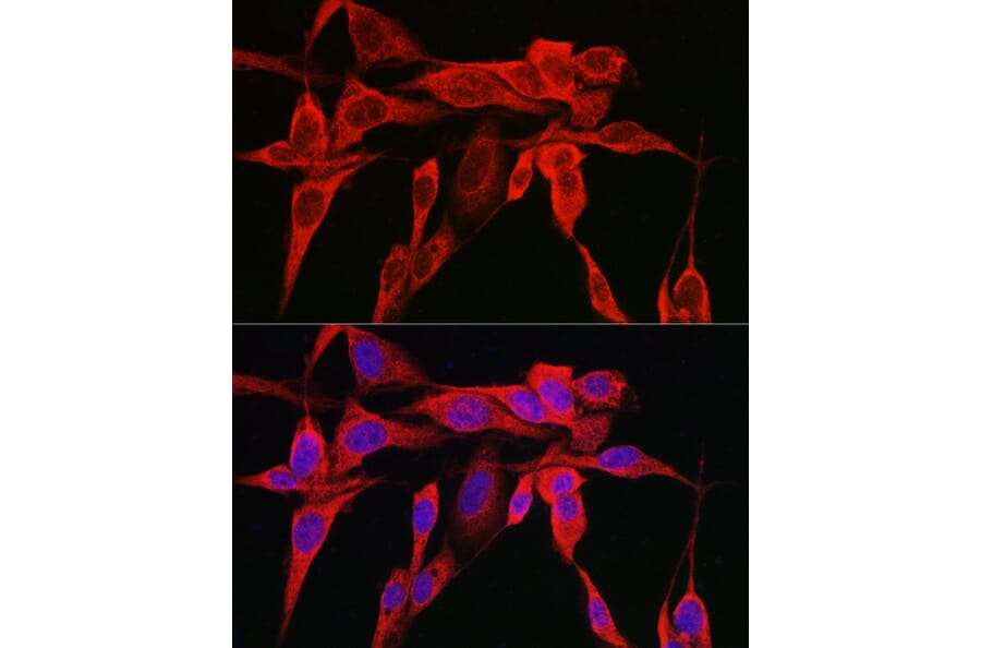 Immunofluorescence - Anti-IRE1 Antibody (A92812) - Antibodies.com