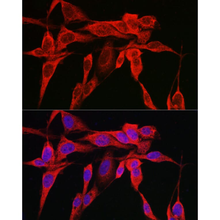 Immunofluorescence - Anti-IRE1 Antibody (A92812) - Antibodies.com