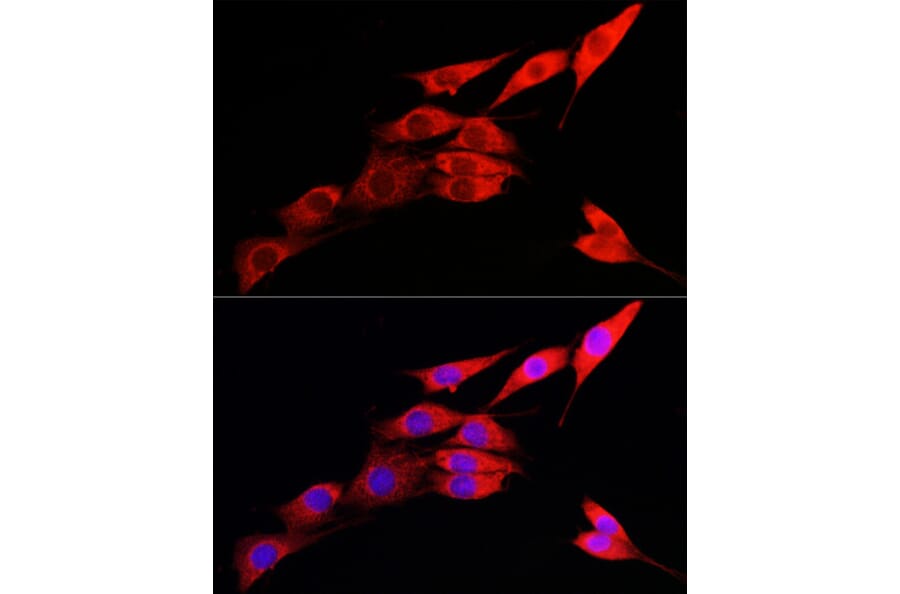 Immunofluorescence - Anti-IRE1 Antibody (A92812) - Antibodies.com