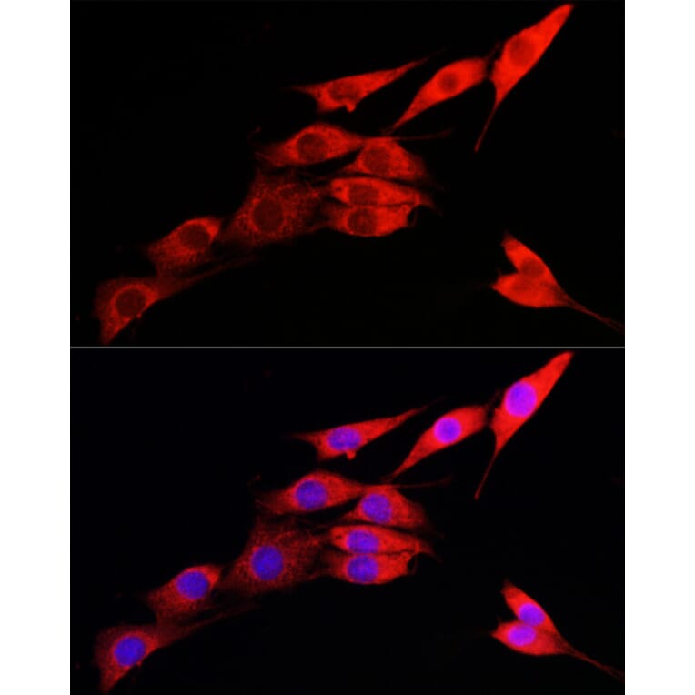 Immunofluorescence - Anti-IRE1 Antibody (A92812) - Antibodies.com