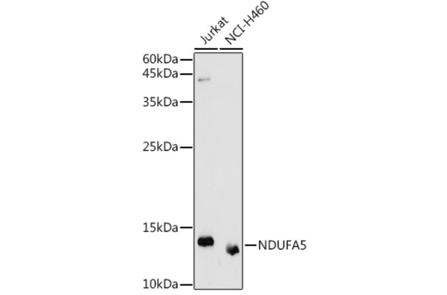 Western Blot - Anti-NDUFA5 Antibody (A92815) - Antibodies.com