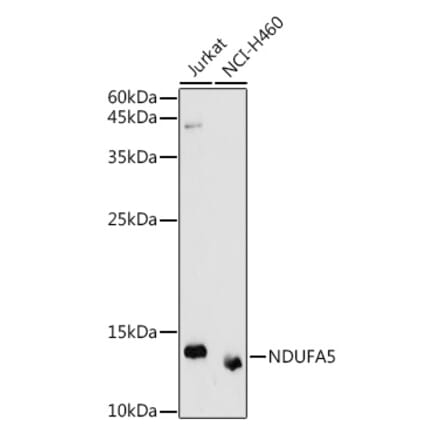 Western Blot - Anti-NDUFA5 Antibody (A92815) - Antibodies.com