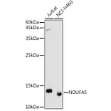 Western Blot - Anti-NDUFA5 Antibody (A92815) - Antibodies.com