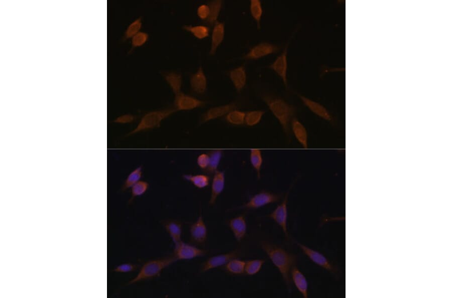 Immunofluorescence - Anti-NDUFA5 Antibody (A92815) - Antibodies.com