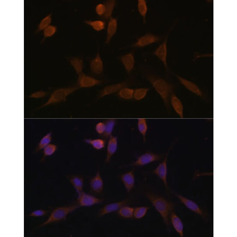 Immunofluorescence - Anti-NDUFA5 Antibody (A92815) - Antibodies.com