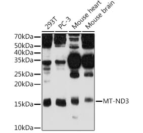 Western Blot - Anti-MT-ND3 Antibody (A92816) - Antibodies.com
