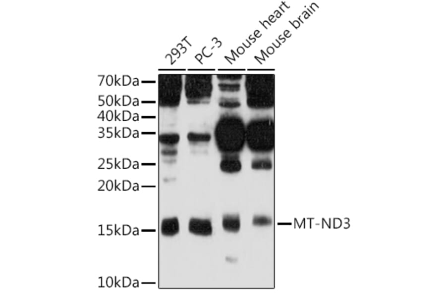 Western Blot - Anti-MT-ND3 Antibody (A92816) - Antibodies.com