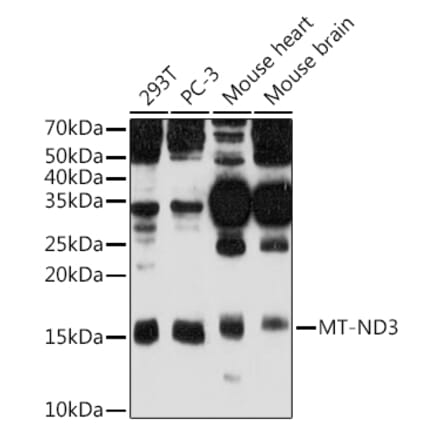 Western Blot - Anti-MT-ND3 Antibody (A92816) - Antibodies.com