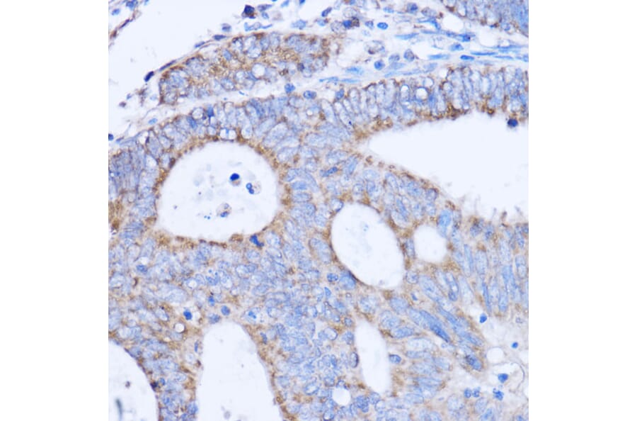 Immunohistochemistry - Anti-MT-ND3 Antibody (A92816) - Antibodies.com