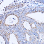 Immunohistochemistry - Anti-MT-ND3 Antibody (A92816) - Antibodies.com