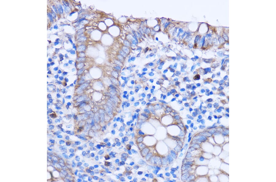 Immunohistochemistry - Anti-MT-ND3 Antibody (A92816) - Antibodies.com