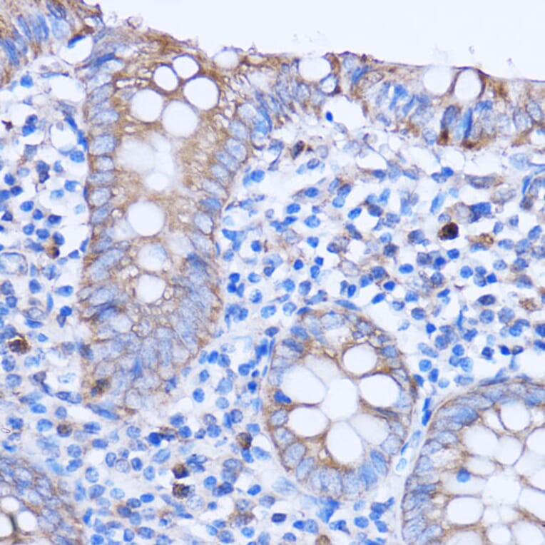 Immunohistochemistry - Anti-MT-ND3 Antibody (A92816) - Antibodies.com