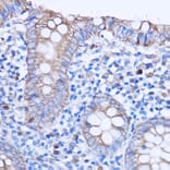 Immunohistochemistry - Anti-MT-ND3 Antibody (A92816) - Antibodies.com