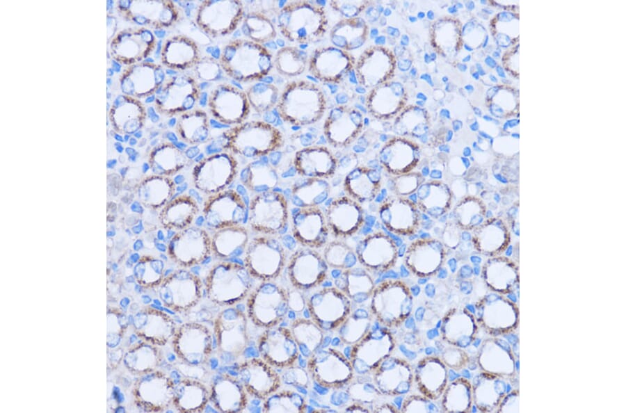 Immunohistochemistry - Anti-MT-ND3 Antibody (A92816) - Antibodies.com