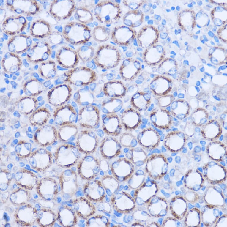 Immunohistochemistry - Anti-MT-ND3 Antibody (A92816) - Antibodies.com