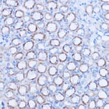 Immunohistochemistry - Anti-MT-ND3 Antibody (A92816) - Antibodies.com