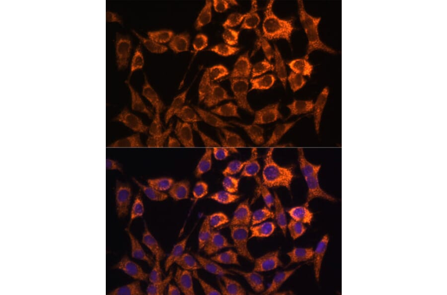 Immunofluorescence - Anti-MT-ND3 Antibody (A92816) - Antibodies.com
