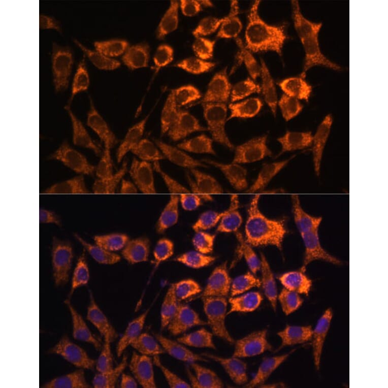 Immunofluorescence - Anti-MT-ND3 Antibody (A92816) - Antibodies.com