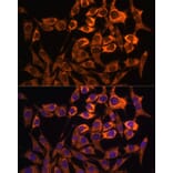 Immunofluorescence - Anti-MT-ND3 Antibody (A92816) - Antibodies.com