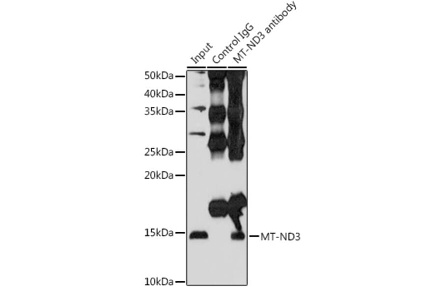 Western Blot - Anti-MT-ND3 Antibody (A92816) - Antibodies.com