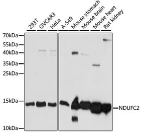 Western Blot - Anti-NDUFC2 Antibody (A92817) - Antibodies.com