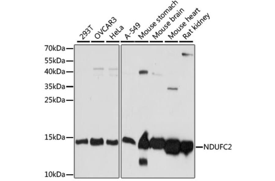 Western Blot - Anti-NDUFC2 Antibody (A92817) - Antibodies.com