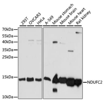 Western Blot - Anti-NDUFC2 Antibody (A92817) - Antibodies.com