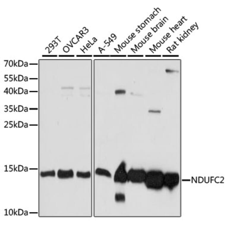 Western Blot - Anti-NDUFC2 Antibody (A92817) - Antibodies.com