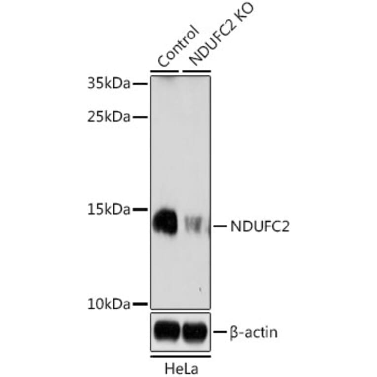 Western Blot - Anti-NDUFC2 Antibody (A92817) - Antibodies.com