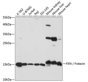 Western Blot - Anti-Frataxin Antibody (A92818) - Antibodies.com