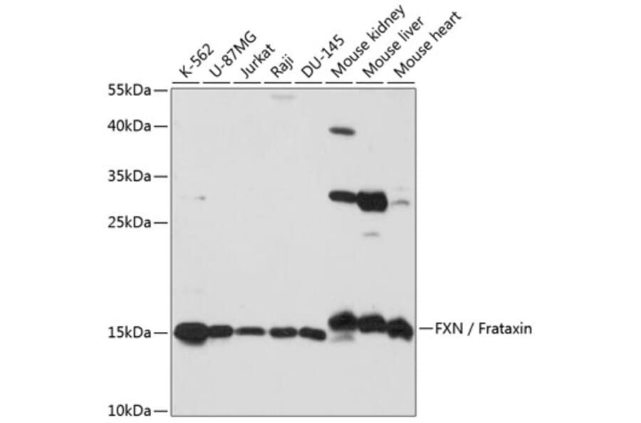 Western Blot - Anti-Frataxin Antibody (A92818) - Antibodies.com