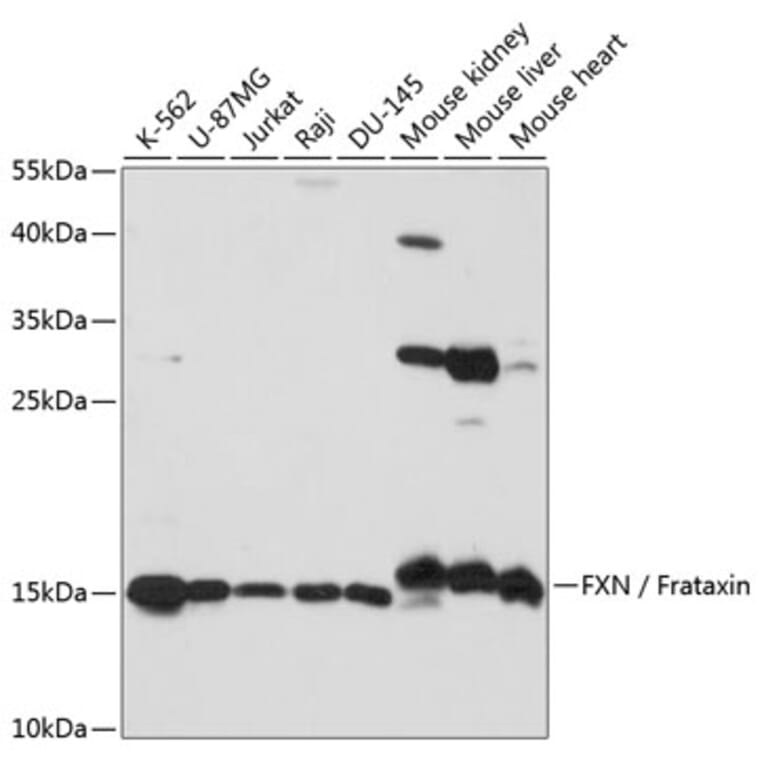 Western Blot - Anti-Frataxin Antibody (A92818) - Antibodies.com