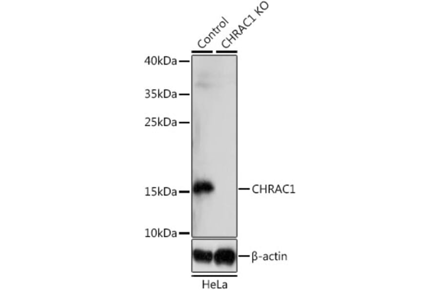 Western Blot - Anti-CHRAC1 Antibody (A92819) - Antibodies.com