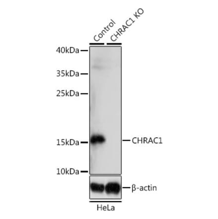 Western Blot - Anti-CHRAC1 Antibody (A92819) - Antibodies.com