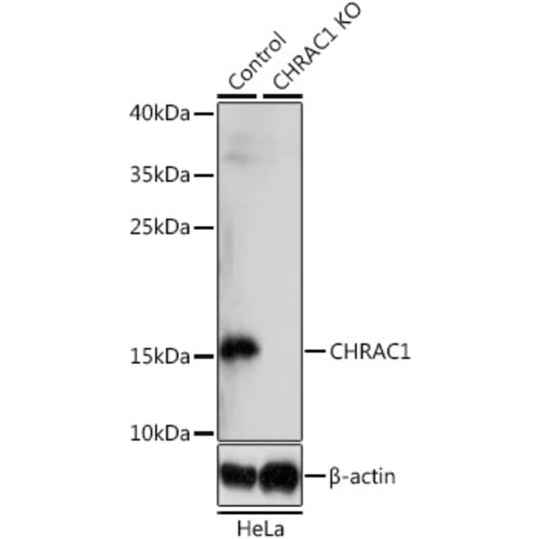 Western Blot - Anti-CHRAC1 Antibody (A92819) - Antibodies.com