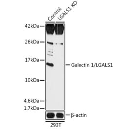 Western Blot - Anti-Galectin 1 Antibody (A92820) - Antibodies.com