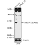 Western Blot - Anti-Galectin 1 Antibody (A92820) - Antibodies.com